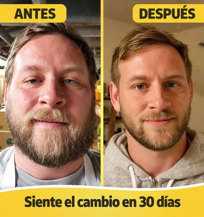 Vitalyn® menos hinchazón, más ligereza y comodidad en tu día